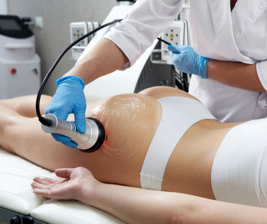Beauty Stories Esthetic Thermolifting rádiófrekvenciás feszesítés